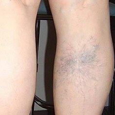 Venusocks